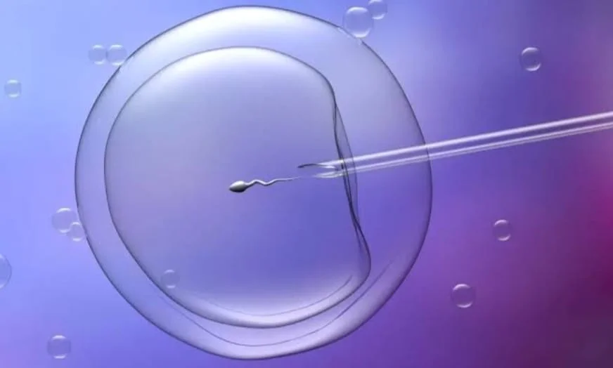 ICSI treatment procedure